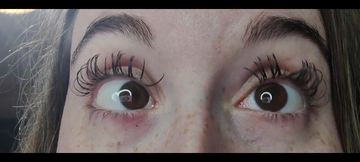 Crossing the Eyes