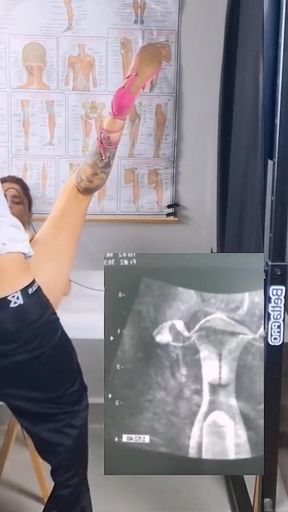 Wife cheating on husband on ultrasound with gynecologist!   Clip 3