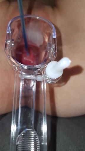 Sperm directly into the uterus   Clip 1