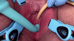 catheter and g-spot vibrator (1080 wmv)