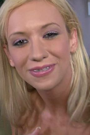 Aim 4 My Braces