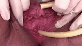 catheter and surgical gloves