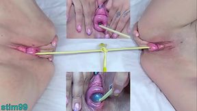Prolapsed Cervix Lesbians at the same time