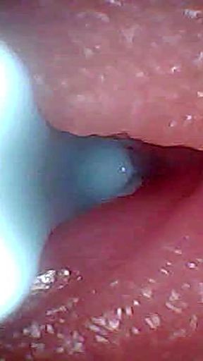 I couldn't believe what happens INSIDE the penis as sperm passes through (endoscopic footage)   Clip 1